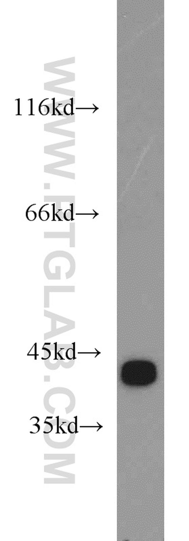 GOT2 Antibody in Western Blot (WB)