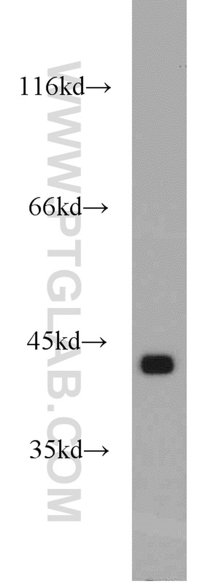 GOT2 Antibody in Western Blot (WB)