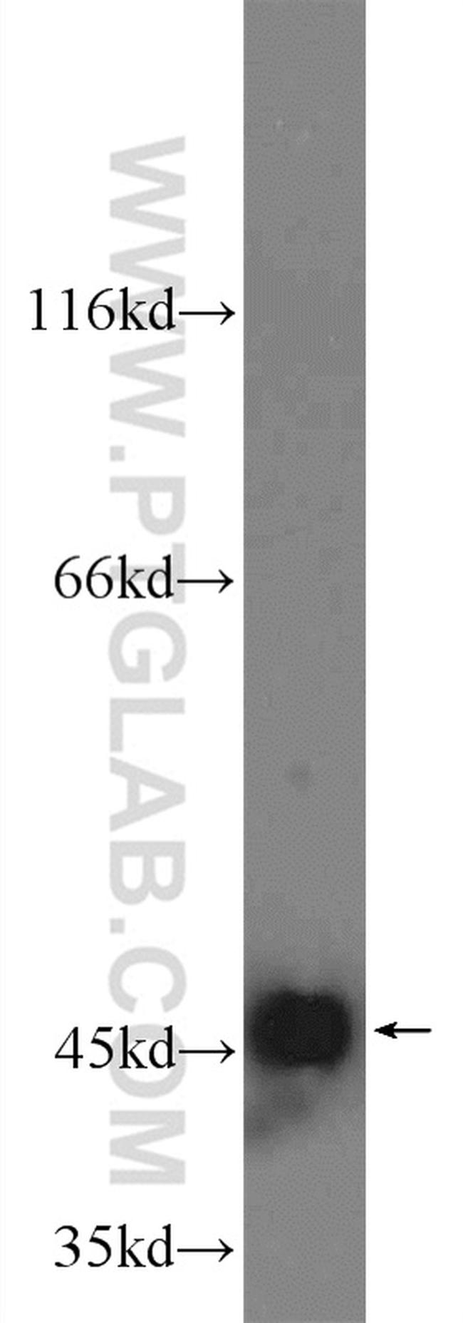 GOT2 Antibody in Western Blot (WB)