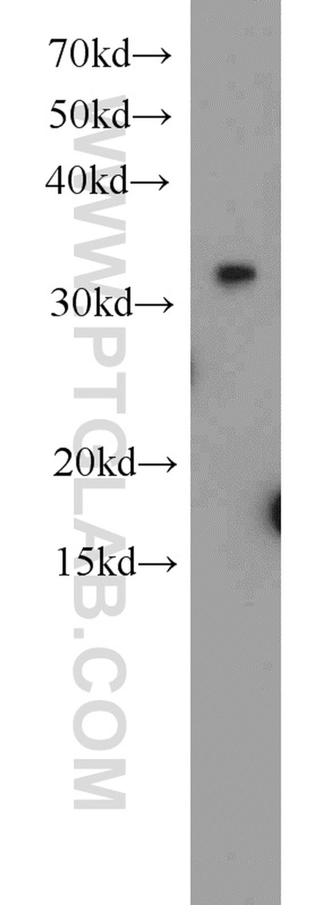 EXOSC2 Antibody in Western Blot (WB)