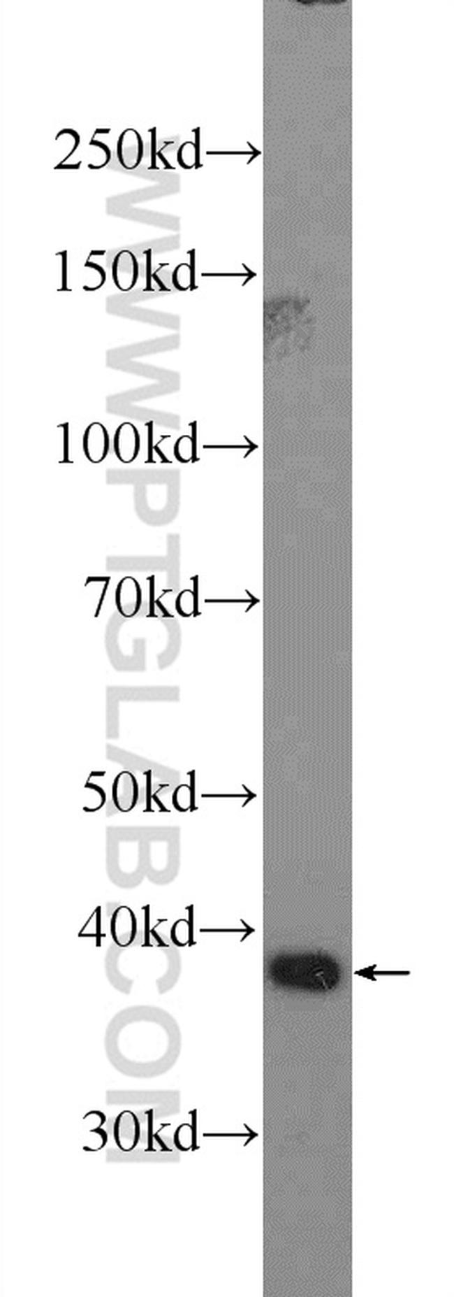 HMOX2 Antibody in Western Blot (WB)