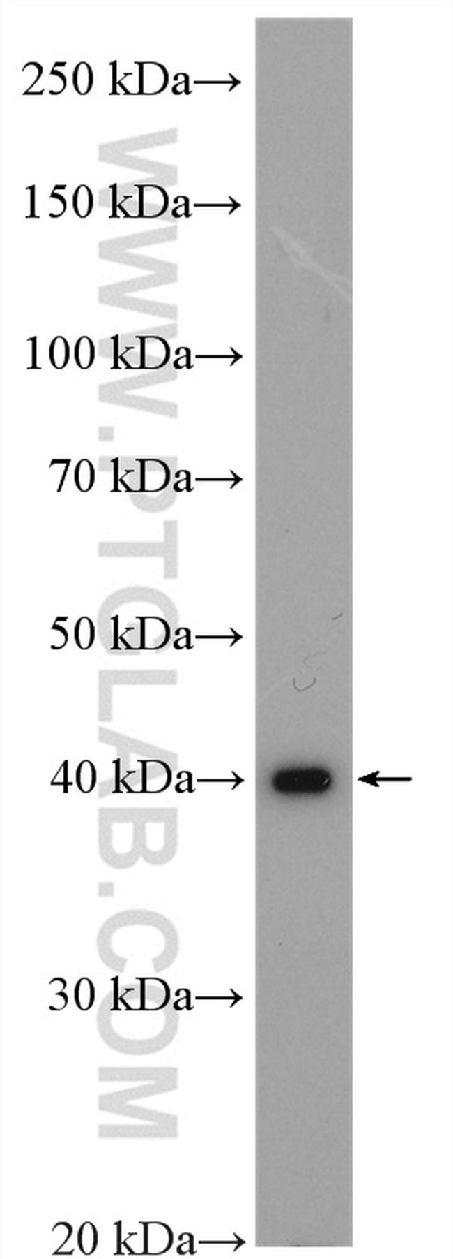 GIPC1 Antibody in Western Blot (WB)
