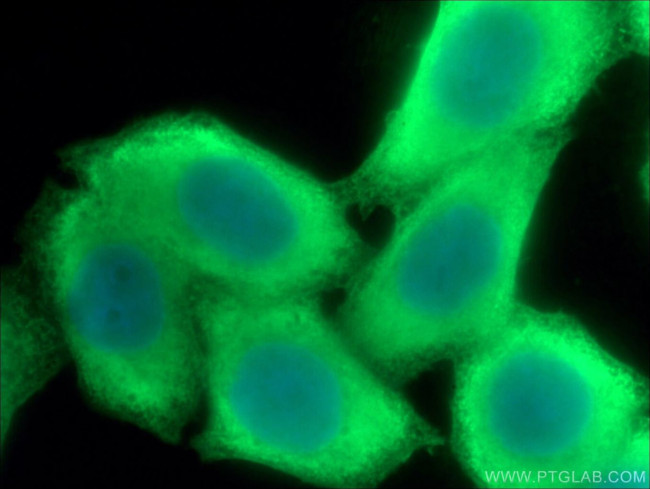 LDHB Antibody in Immunocytochemistry (ICC/IF)