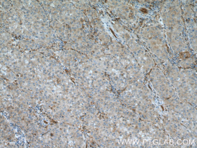 PIG3 Antibody in Immunohistochemistry (Paraffin) (IHC (P))