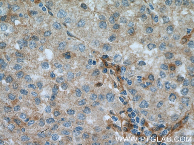 PIG3 Antibody in Immunohistochemistry (Paraffin) (IHC (P))