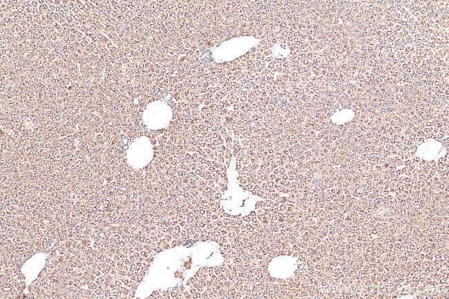 SEC61B Antibody in Immunohistochemistry (Paraffin) (IHC (P))