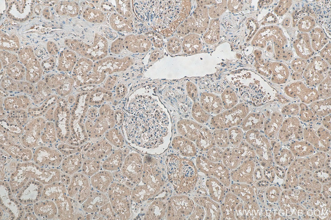 CUL4A Antibody in Immunohistochemistry (Paraffin) (IHC (P))