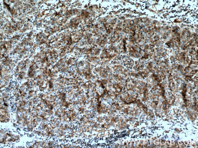 SDHA Antibody in Immunohistochemistry (Paraffin) (IHC (P))