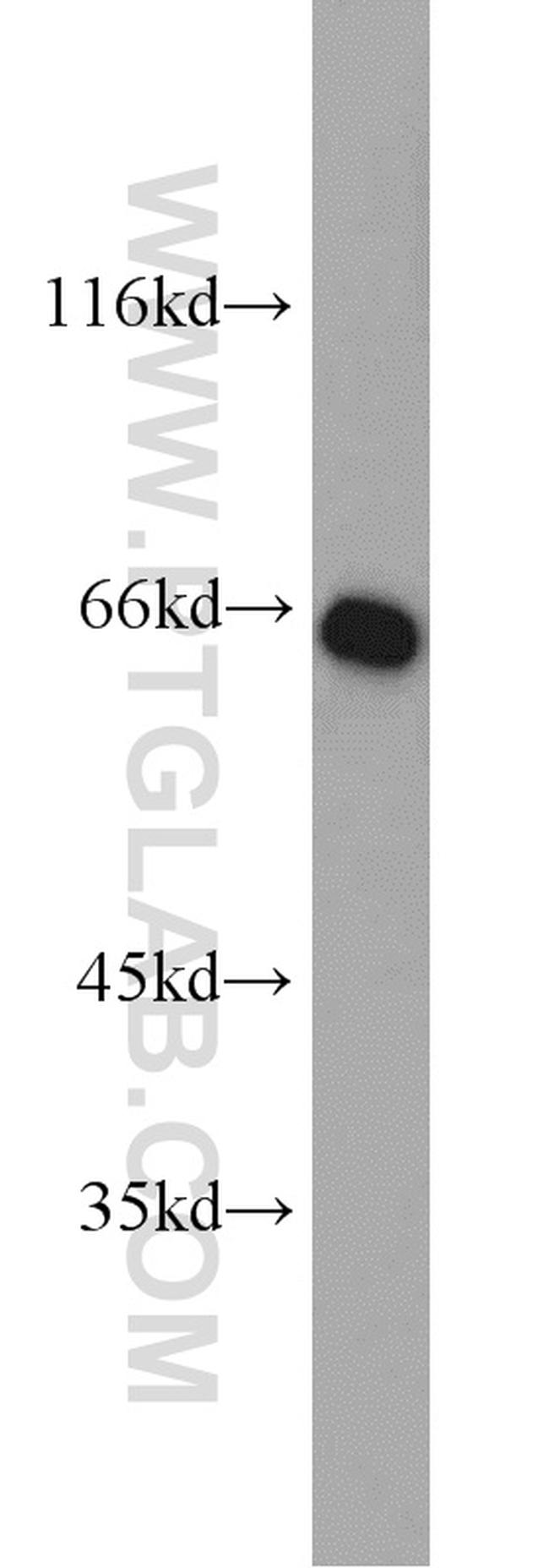 SDHA Antibody in Western Blot (WB)