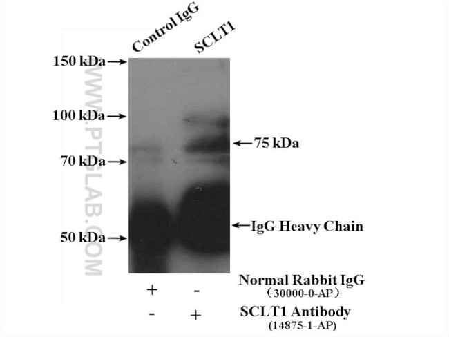 SCLT1 Antibody in Immunoprecipitation (IP)