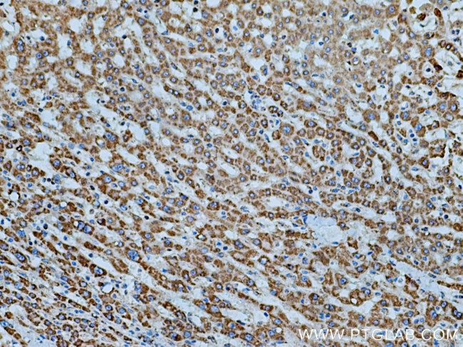 ATP5D Antibody in Immunohistochemistry (Paraffin) (IHC (P))