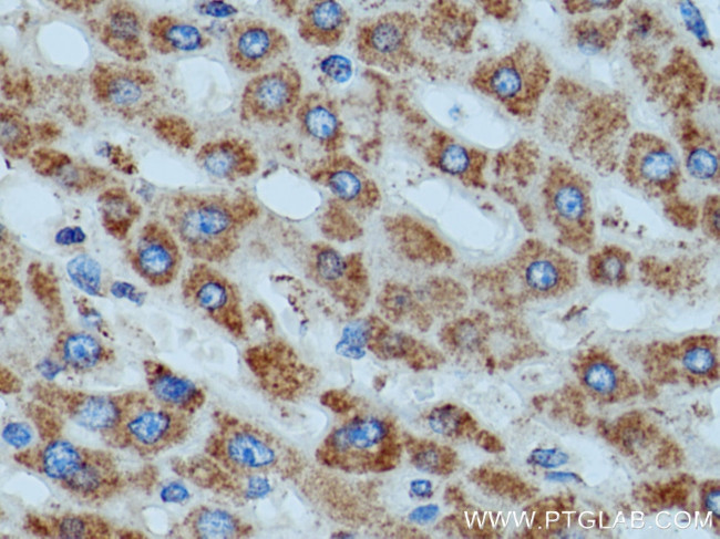 ATP5D Antibody in Immunohistochemistry (Paraffin) (IHC (P))