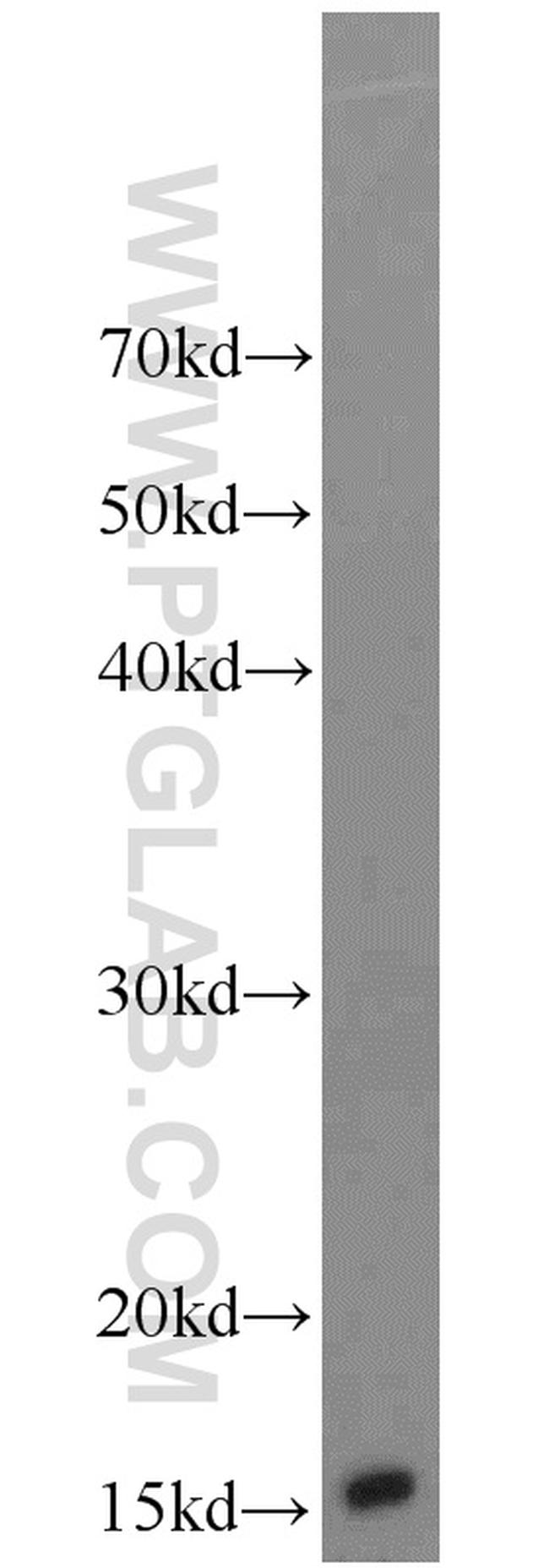 ATP5D Antibody in Western Blot (WB)