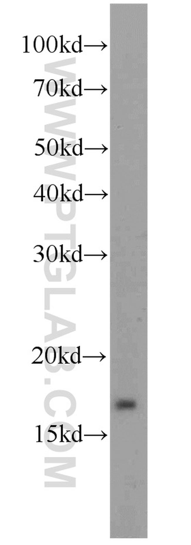 ATP5D Antibody in Western Blot (WB)