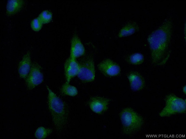 FADD Antibody in Immunocytochemistry (ICC/IF)