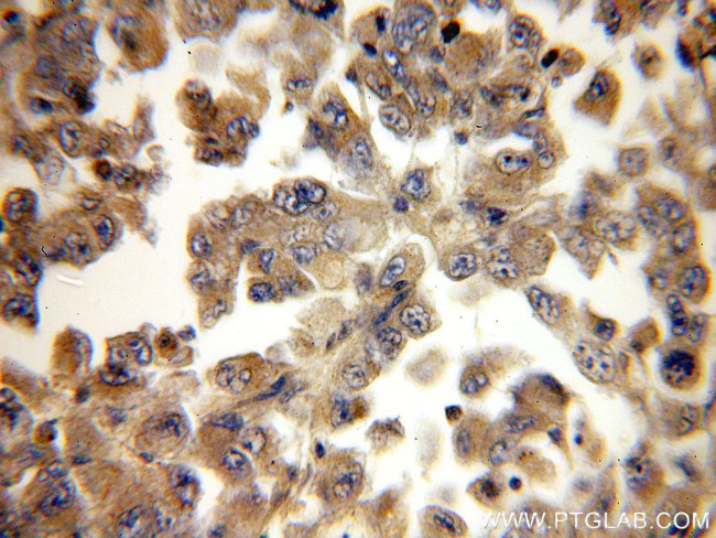 FADD Antibody in Immunohistochemistry (Paraffin) (IHC (P))