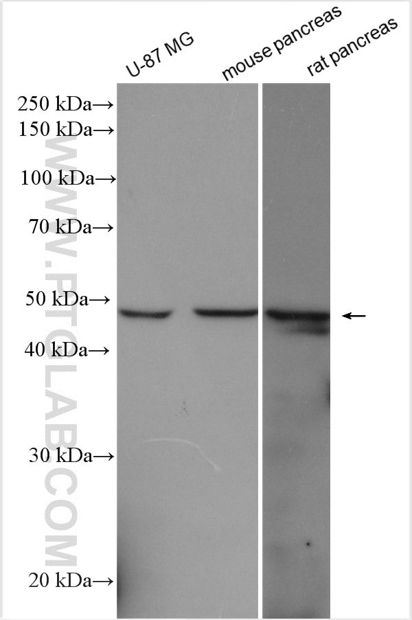 DDOST Antibody in Western Blot (WB)