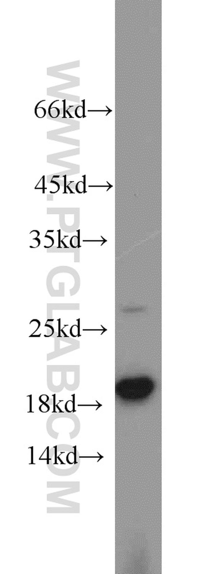 TIM22 Antibody in Western Blot (WB)