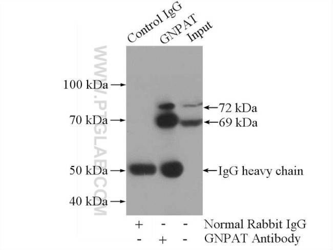 GNPAT Antibody in Immunoprecipitation (IP)