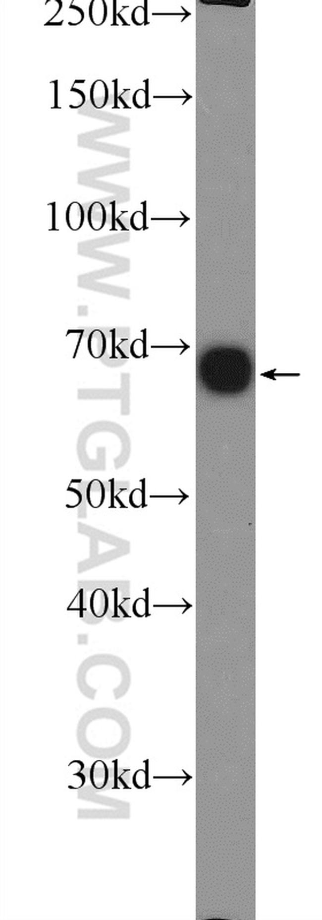 GNPAT Antibody in Western Blot (WB)