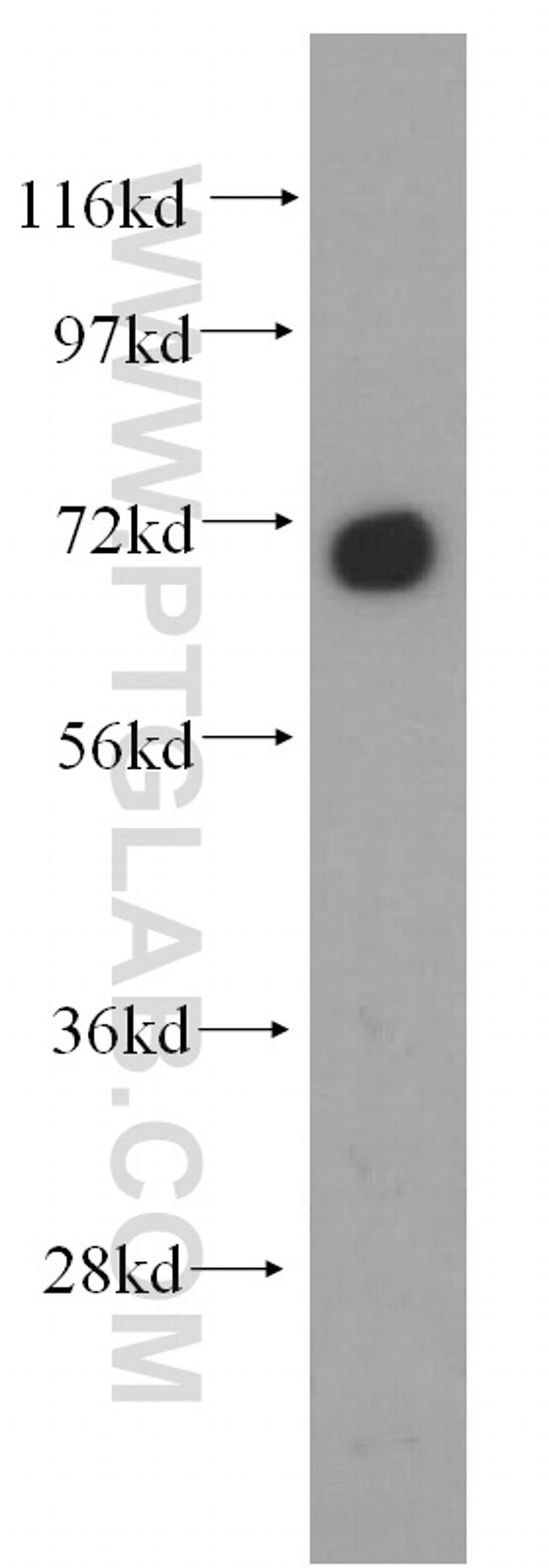 GNPAT Antibody in Western Blot (WB)
