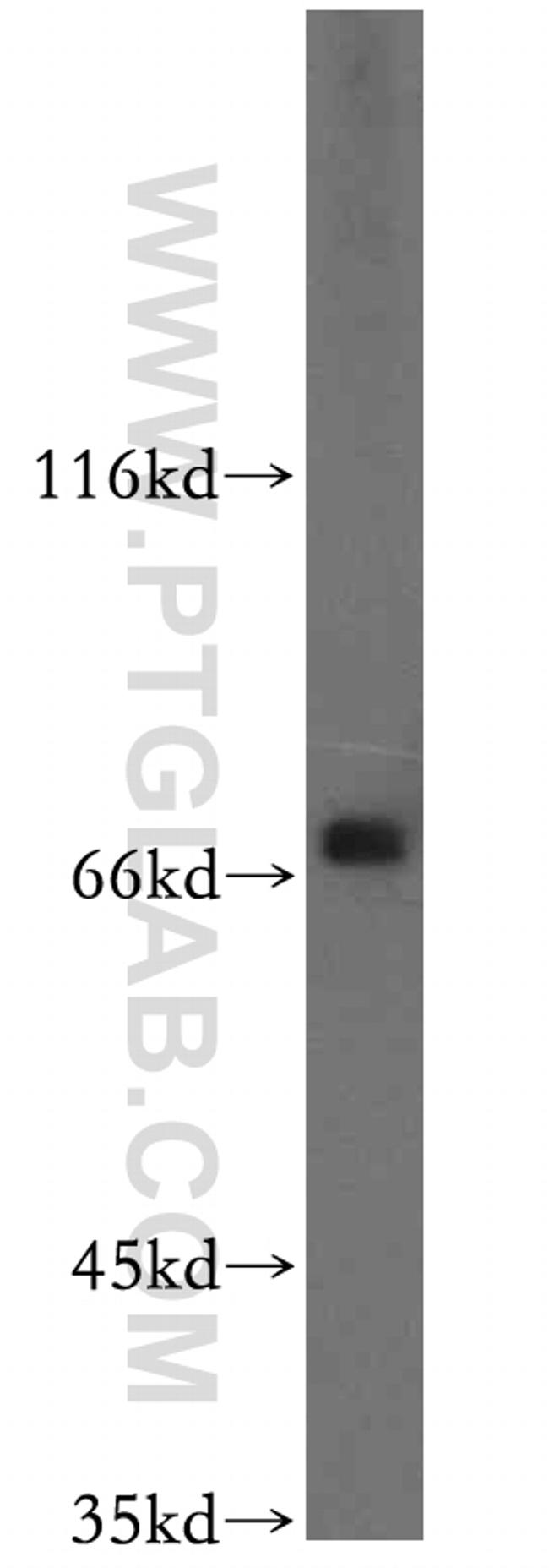 GNPAT Antibody in Western Blot (WB)