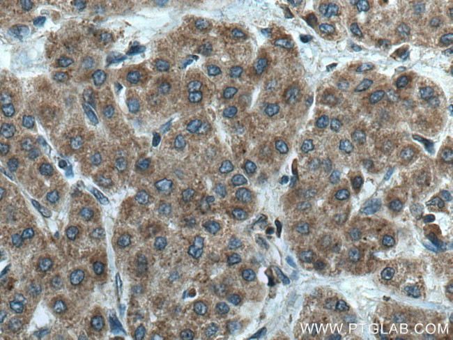 GALNS Antibody in Immunohistochemistry (Paraffin) (IHC (P))