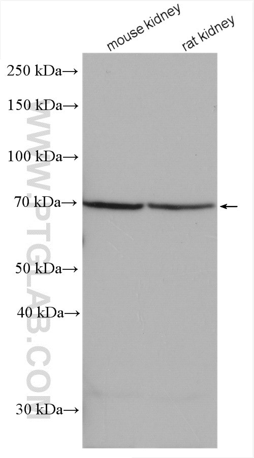 URAT1 Antibody in Western Blot (WB)