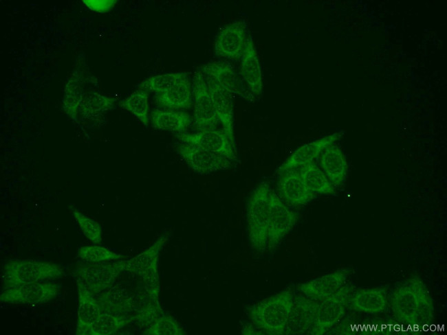 ZAK Antibody in Immunocytochemistry (ICC/IF)