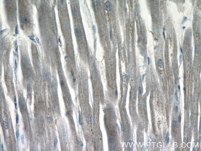 ZAK Antibody in Immunohistochemistry (Paraffin) (IHC (P))