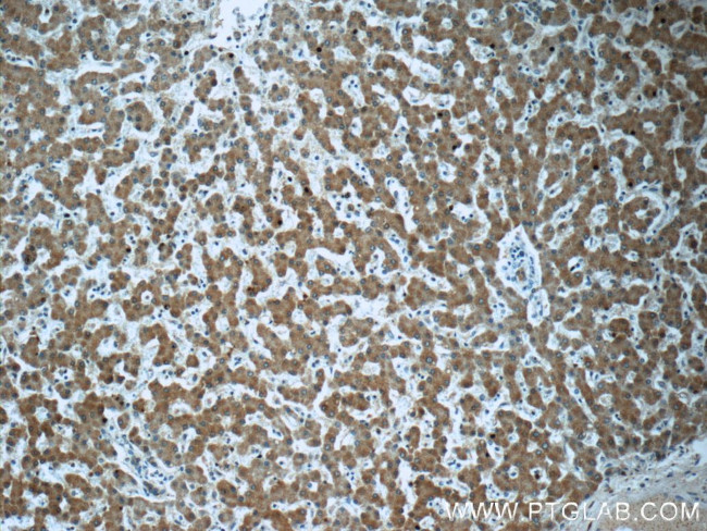 ZAK Antibody in Immunohistochemistry (Paraffin) (IHC (P))