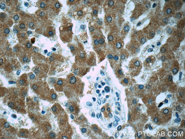 ZAK Antibody in Immunohistochemistry (Paraffin) (IHC (P))