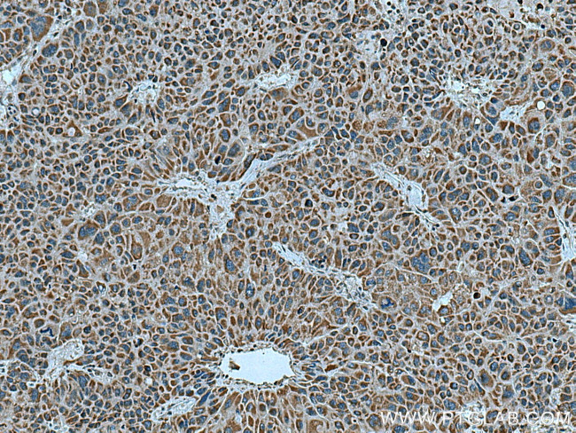 ZAK Antibody in Immunohistochemistry (Paraffin) (IHC (P))