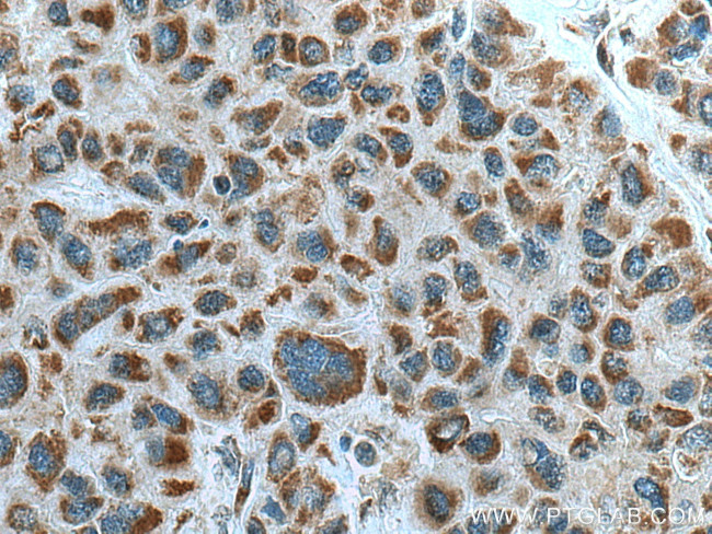 ZAK Antibody in Immunohistochemistry (Paraffin) (IHC (P))