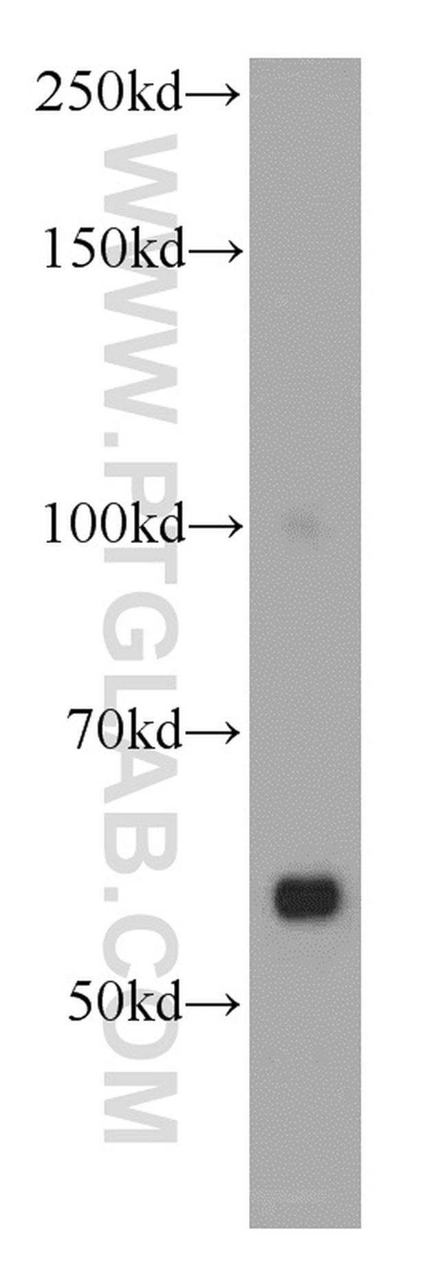 ZAK Antibody in Western Blot (WB)