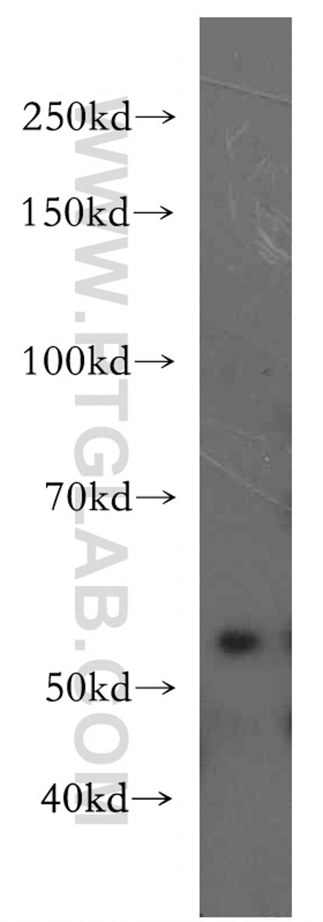 ZAK Antibody in Western Blot (WB)