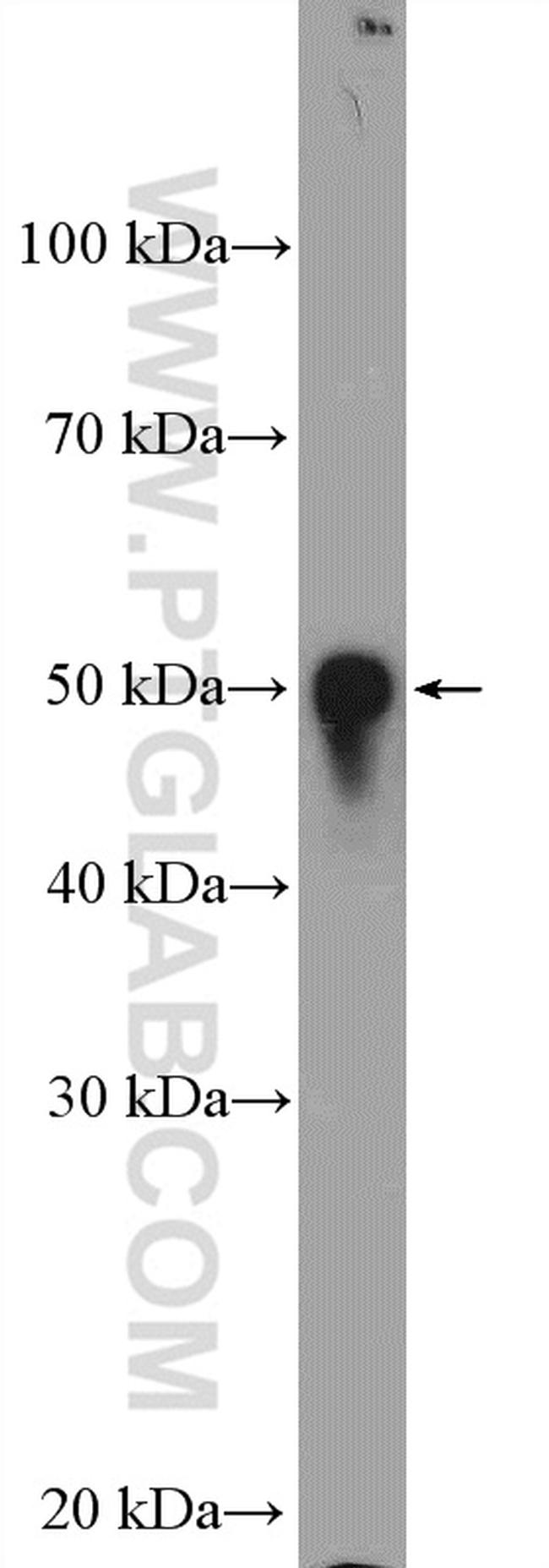 ZAK Antibody in Western Blot (WB)