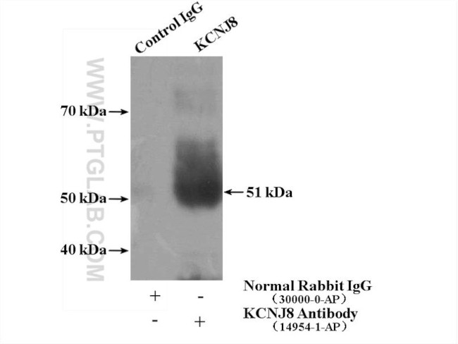 Kir6.1 Antibody in Immunoprecipitation (IP)