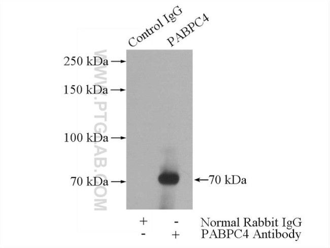 PABPC4 Antibody in Immunoprecipitation (IP)