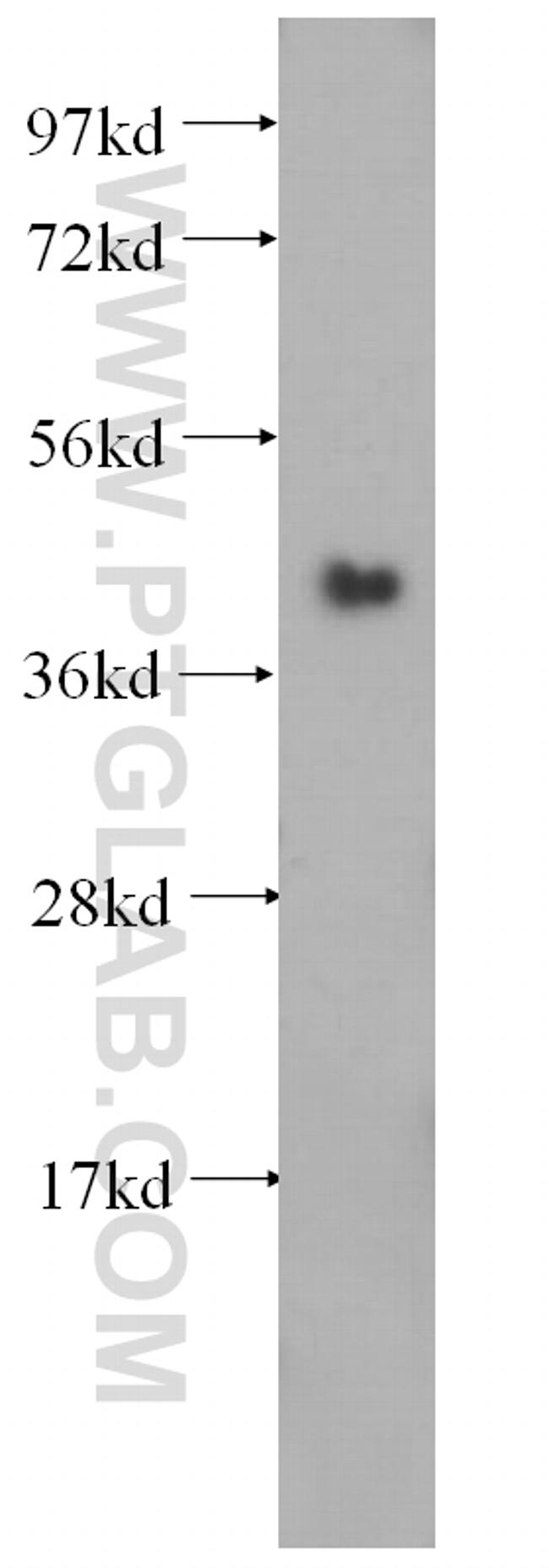 SERPINB6 Antibody in Western Blot (WB)