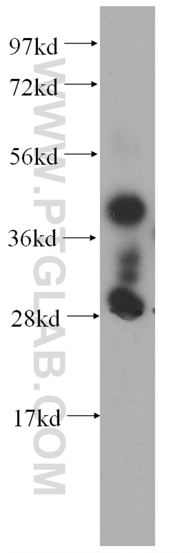 SERPINB6 Antibody in Western Blot (WB)