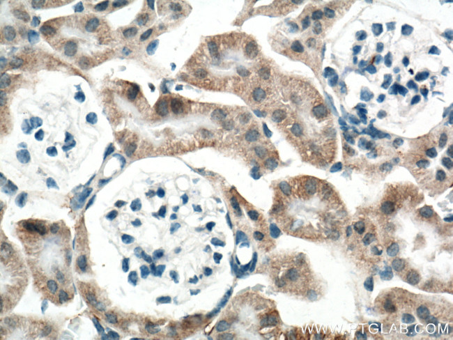 SLC25A39 Antibody in Immunohistochemistry (Paraffin) (IHC (P))