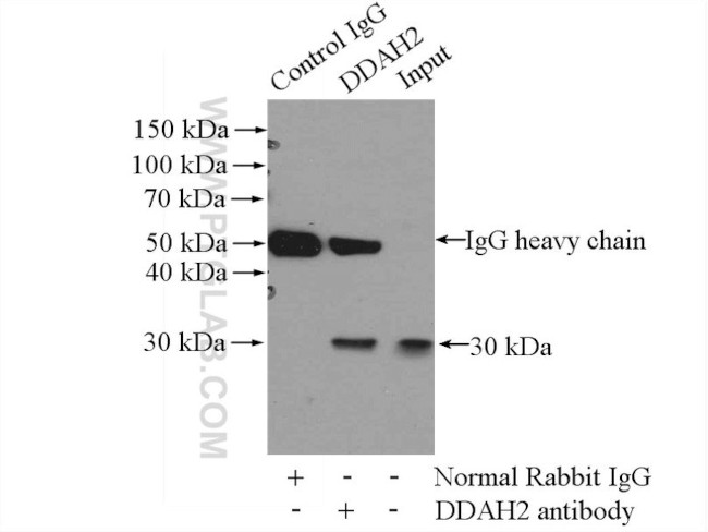 DDAH2 Antibody in Immunoprecipitation (IP)
