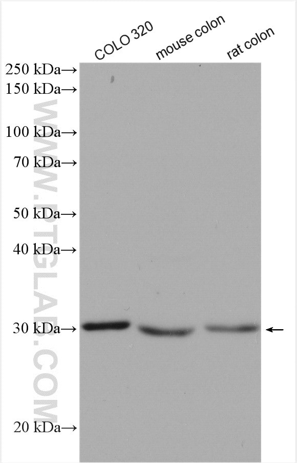 DDAH2 Antibody in Western Blot (WB)