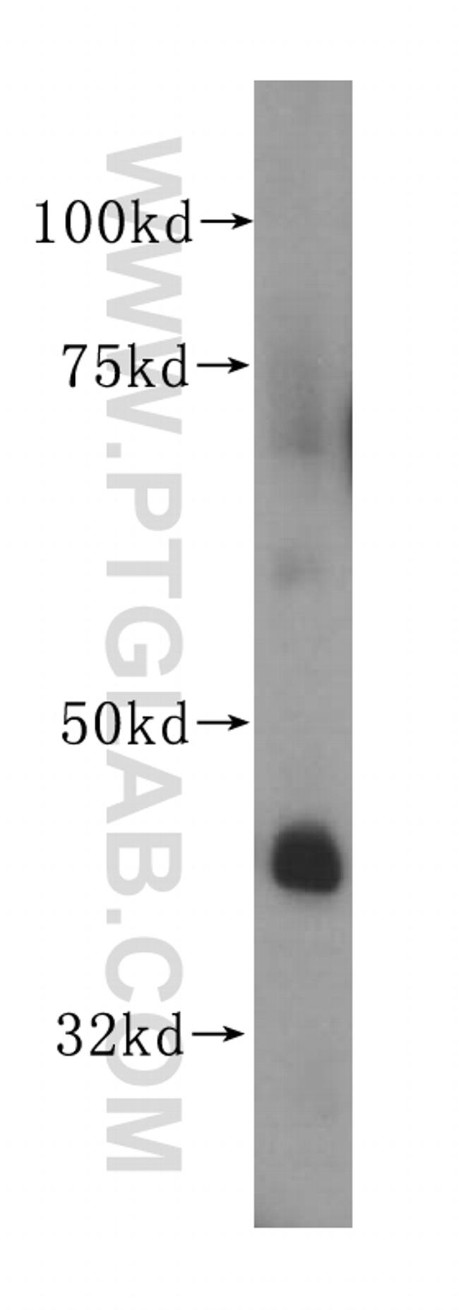 DDAH2 Antibody in Western Blot (WB)