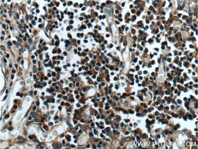 LEF1 Antibody in Immunohistochemistry (Paraffin) (IHC (P))