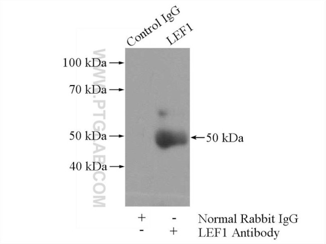 LEF1 Antibody in Immunoprecipitation (IP)