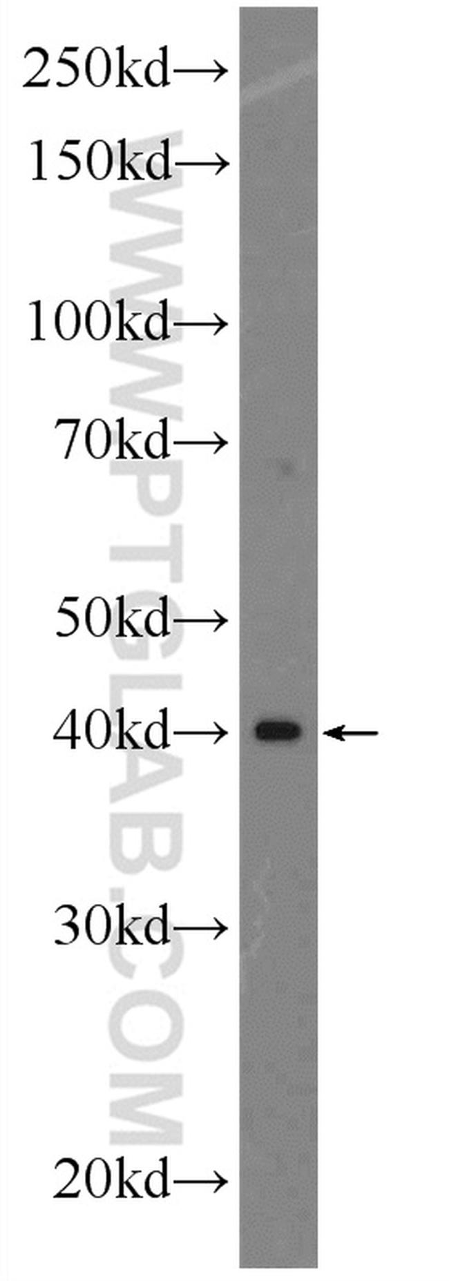 LEF1 Antibody in Western Blot (WB)