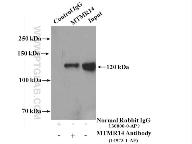 MTMR14 Antibody in Immunoprecipitation (IP)