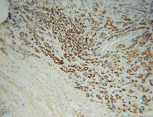 METTL1 Antibody in Immunohistochemistry (Paraffin) (IHC (P))